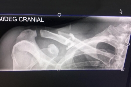 Infirmerie : fracture de la clavicule pour Marco Haller